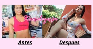 fatima segovia antes y despues